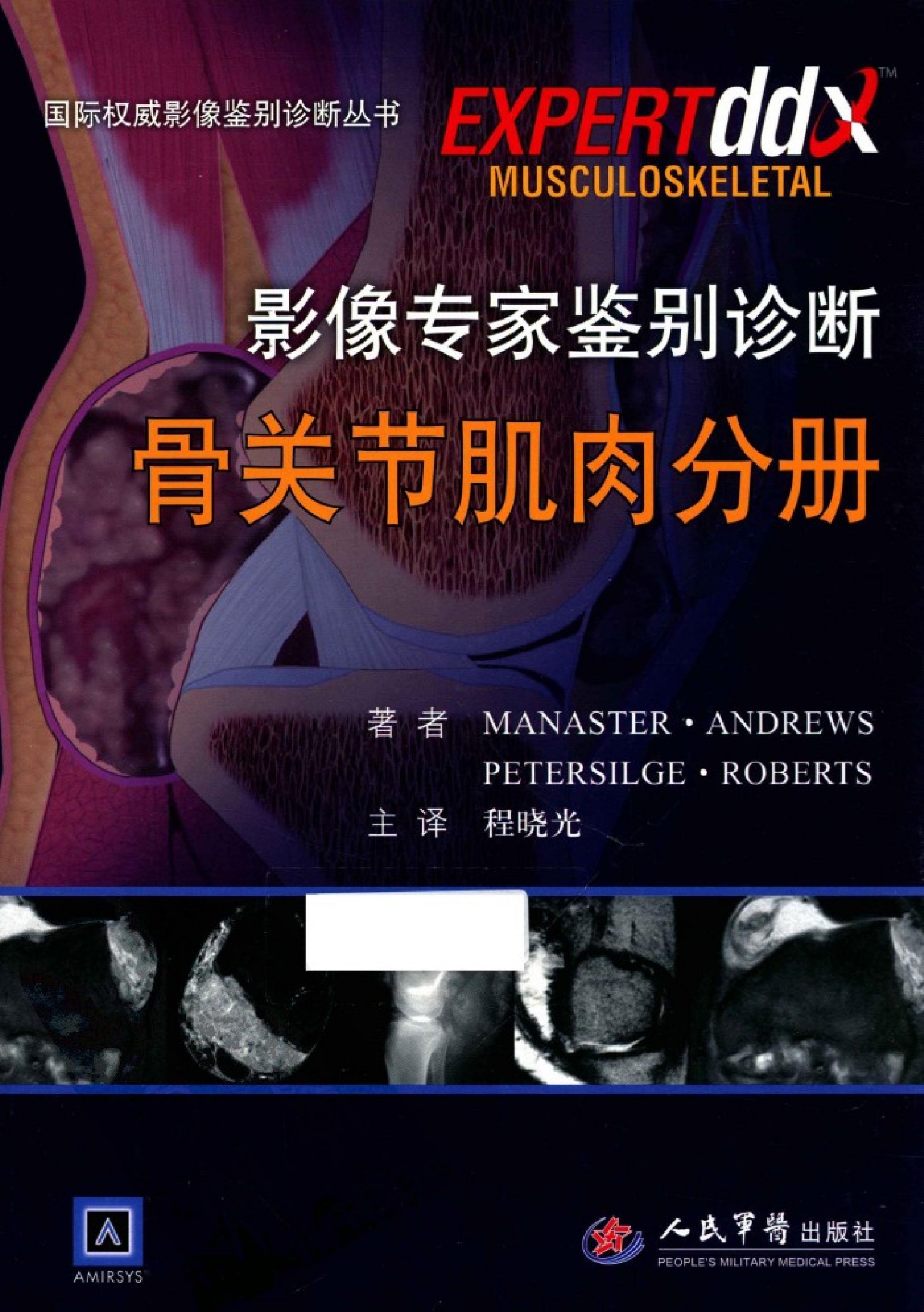 影像专家鉴别诊断：骨关节肌肉分册