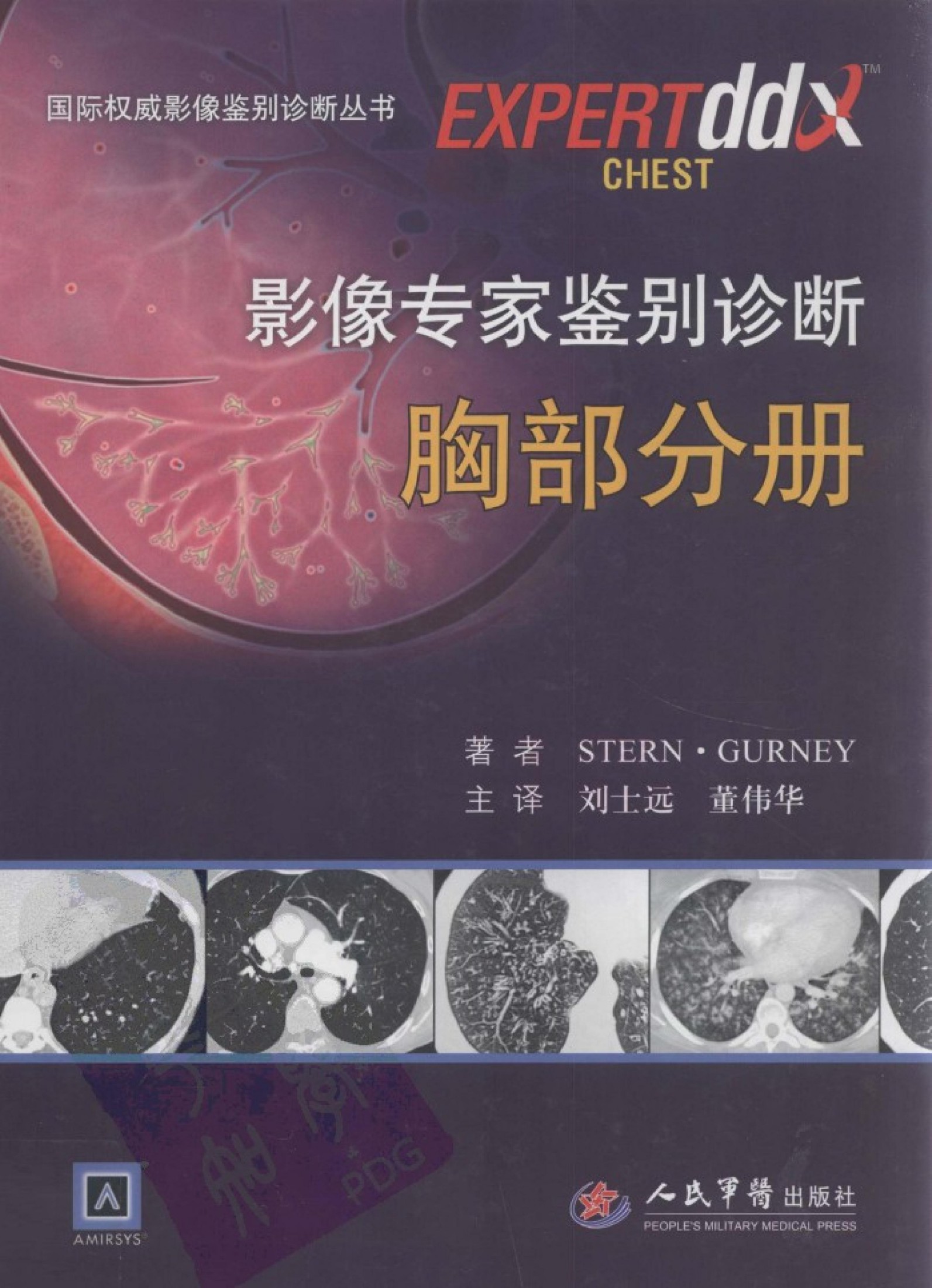 影像专家鉴别诊断：胸部分册