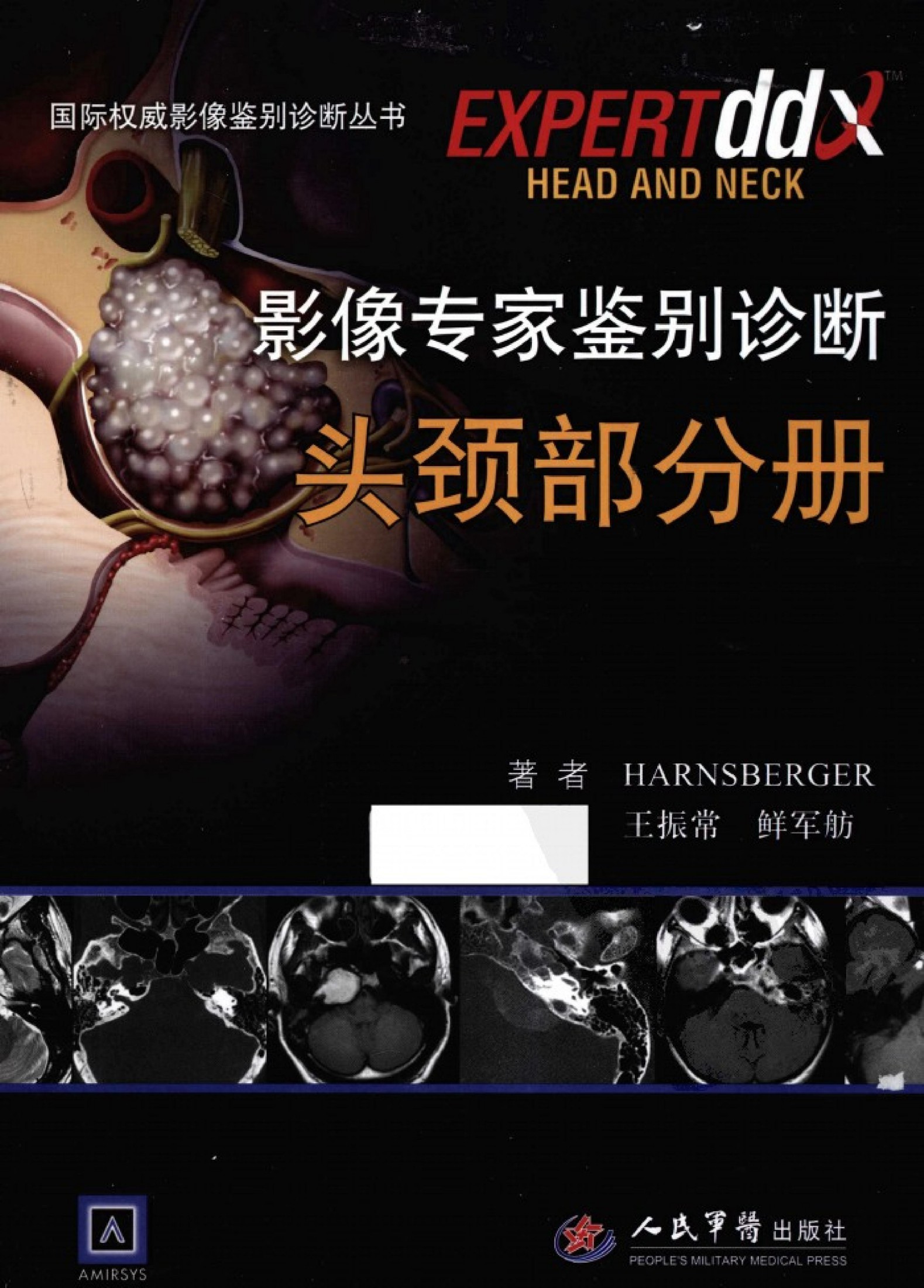 影像专家鉴别诊断：头颈部分册