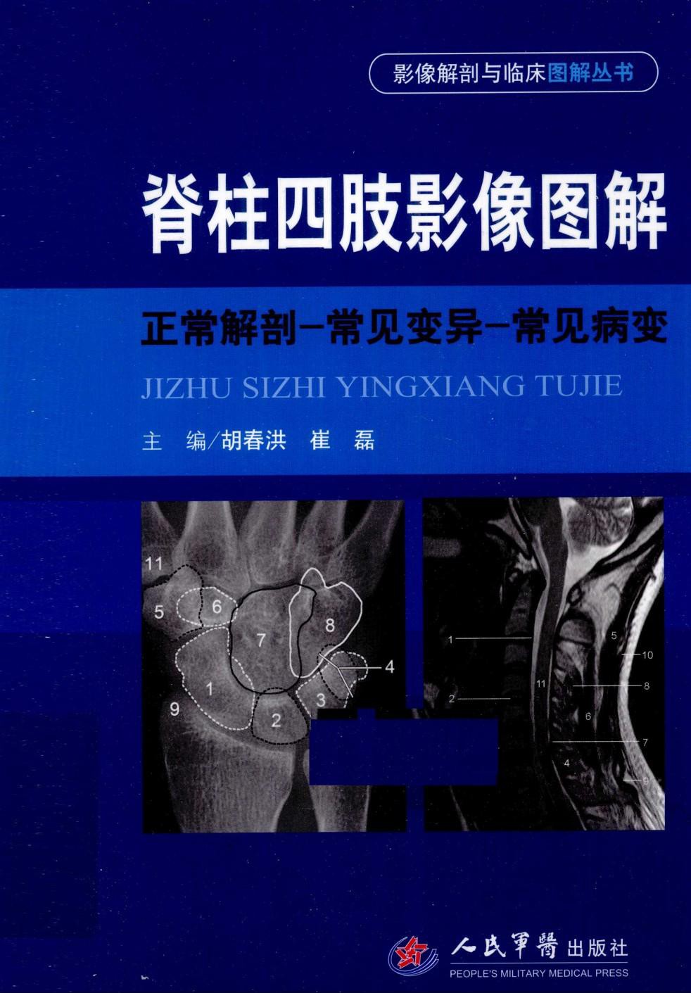 脊柱四肢影像图解