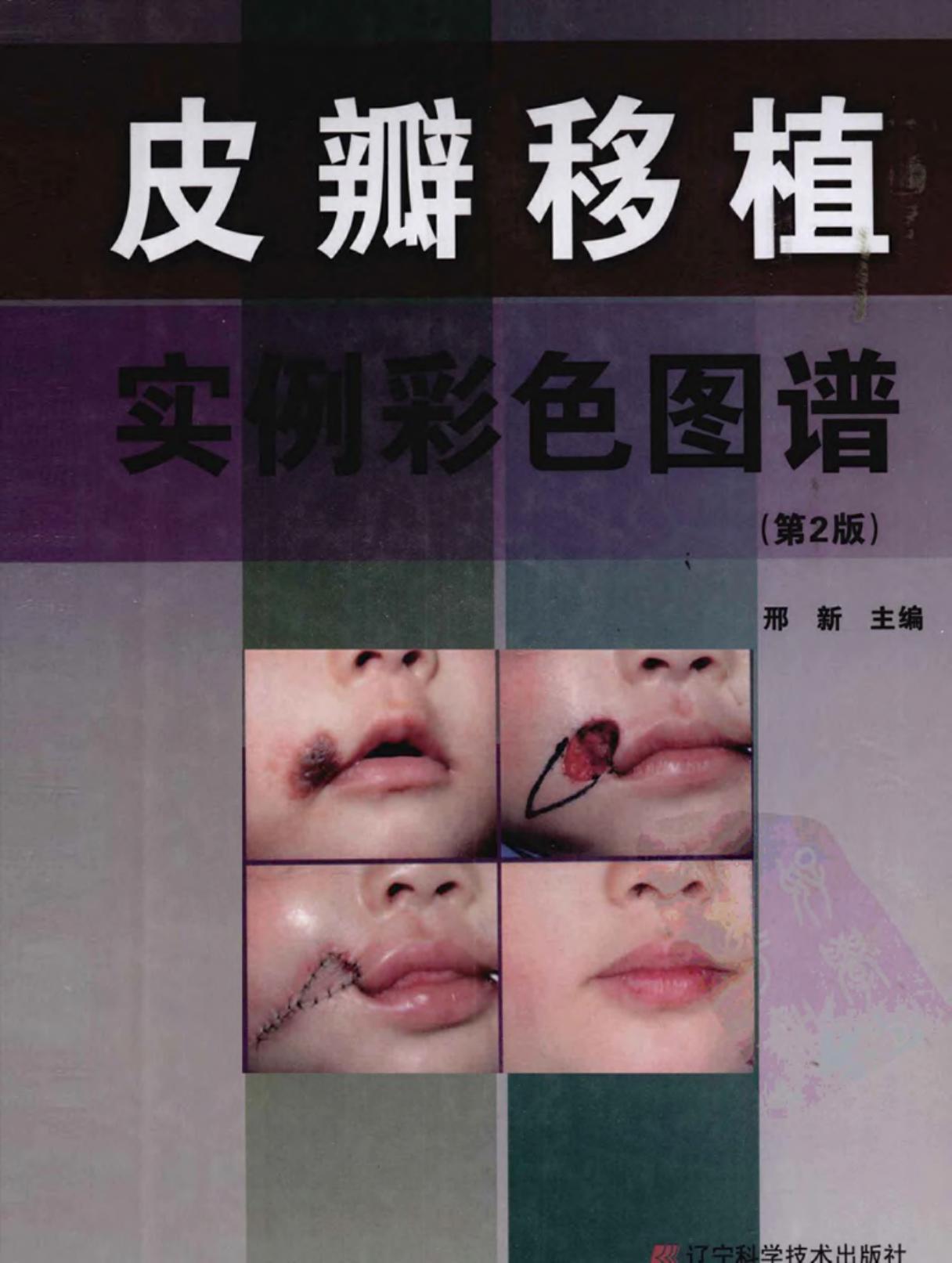皮瓣移植实例彩色图谱