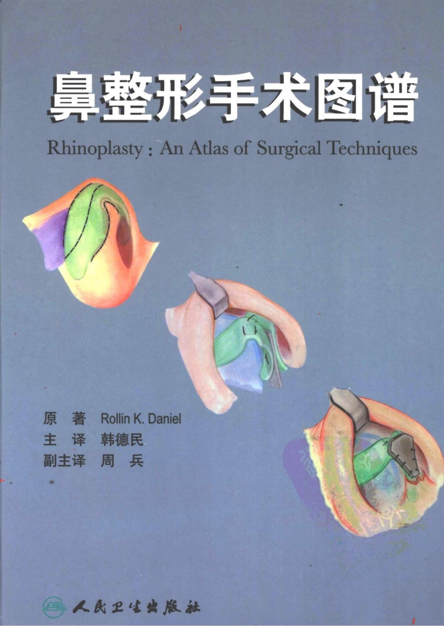 鼻整形手术图谱