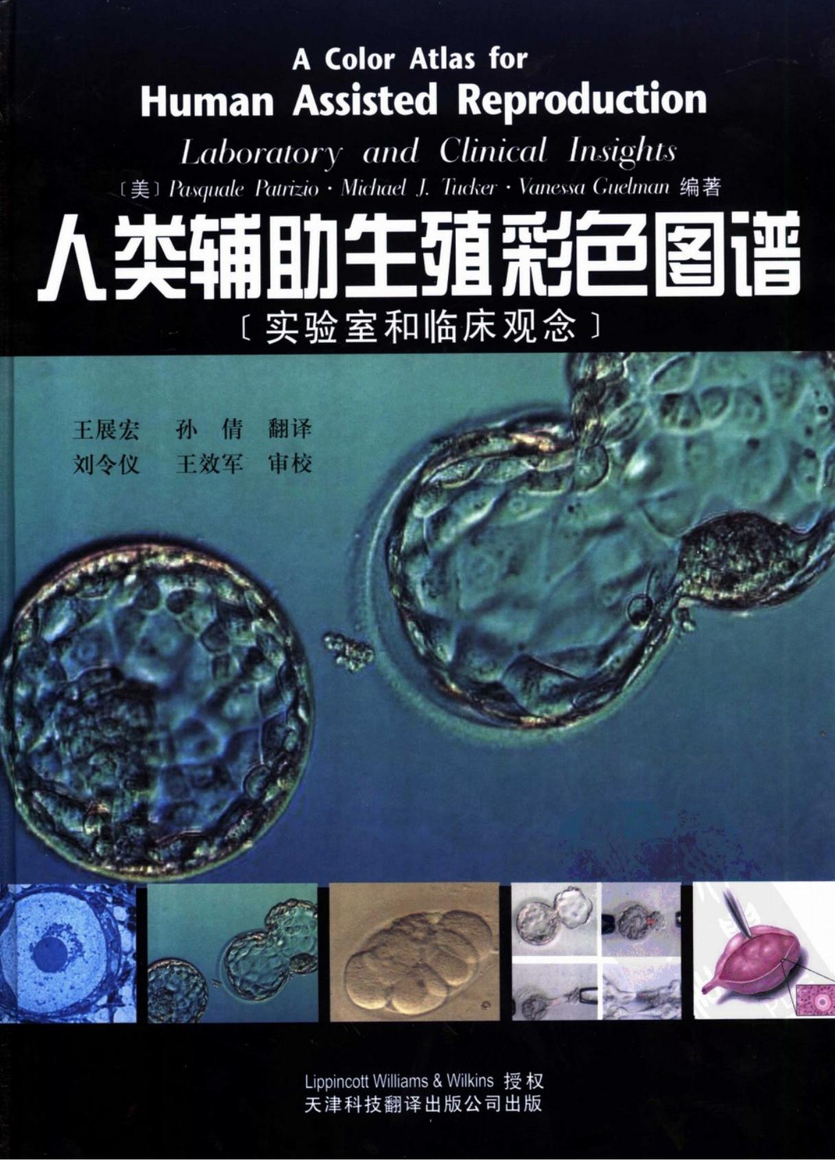 人类辅助生殖彩色图谱：实验室和临床观念